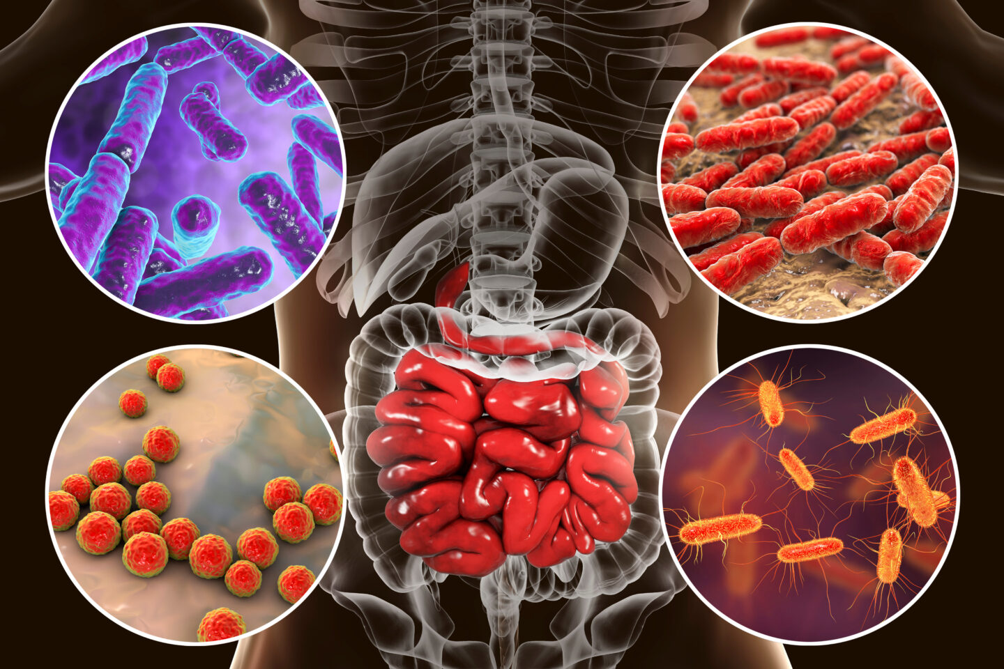 Scopri di più sull'articolo Decifrare l’Asse Intestino-Polmone: Come il Microbiota Intestinale Modella la Battaglia Contro i Virus Respiratori
